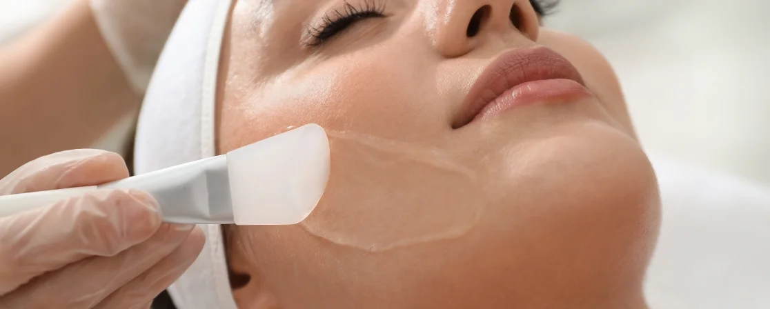 Chemical Peels Skin Rejuvenation in Brampton at Derma Capital Laser Clinic