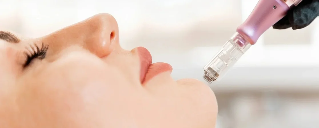 Exosome Therapy in Brampton at Derma Capital Laser Clinic