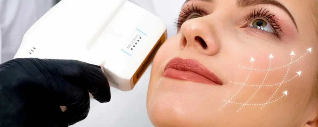 Hifu Skin Tightening in Brampton at Derma Capital Laser Clinic