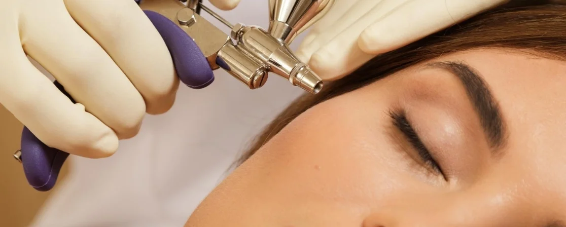 Oxygen Facial in Brampton at Derma Capital Laser Clinic