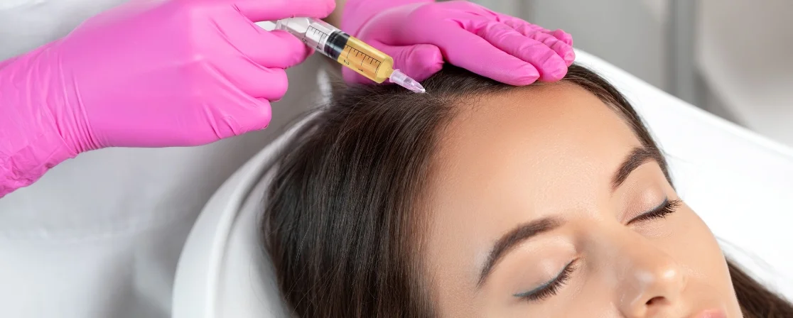 PRP Hair Restoration in Brampton at Derma Capital Laser Clinic