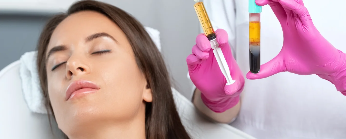 PRP Hair Restoration in Brampton at Derma Capital Laser Clinic