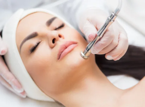 Microdermabrasion