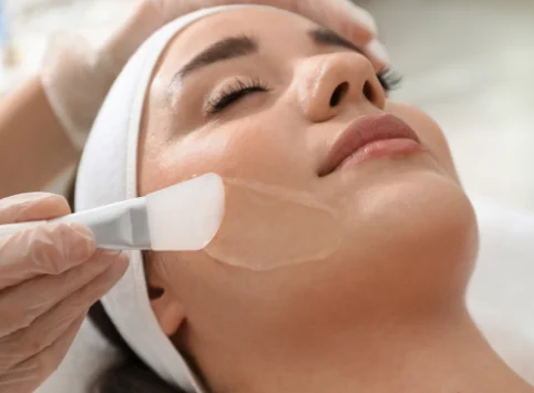 Chemical Peels