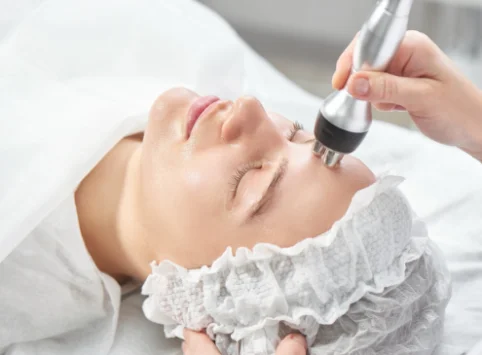 RF Skin Tightening